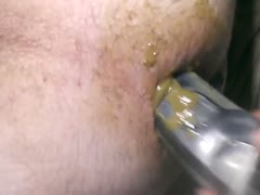 Poop drainer got inserted to hairy ass